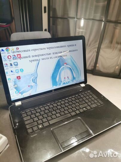 Ноутбук hp pavilion 17 с большим экраном