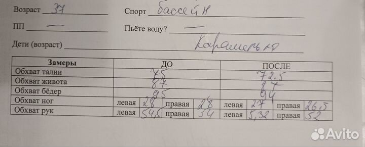 Карамельная липосакция