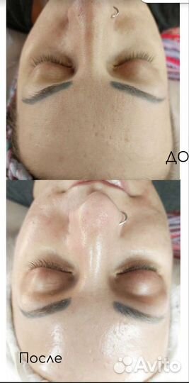 Депиляция/Обучение. Косметология. Кирсанов