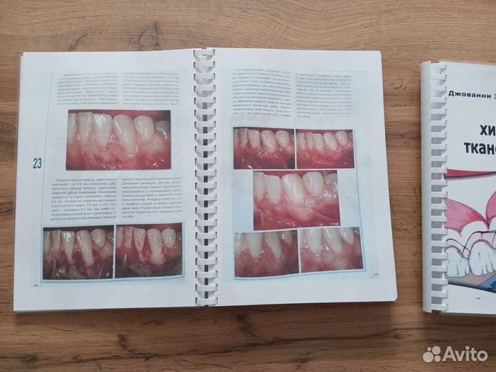Пластическая хирургия мягких тканей