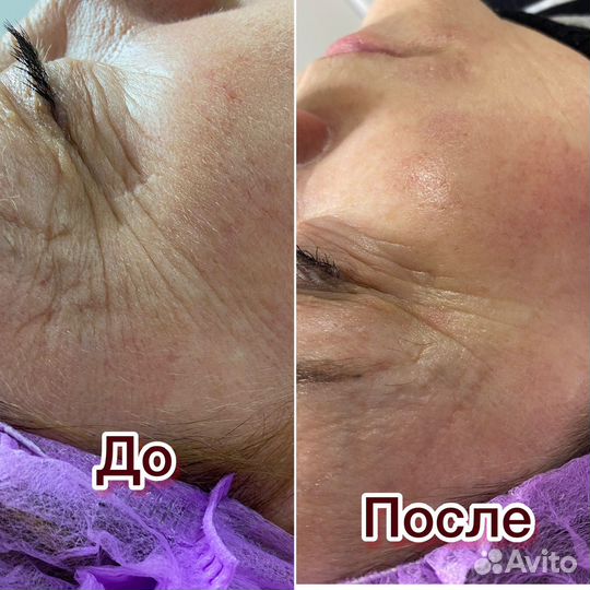 Услуги косметолога