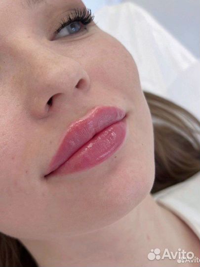 TCA-пилинг лица