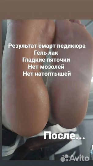 Педикюр