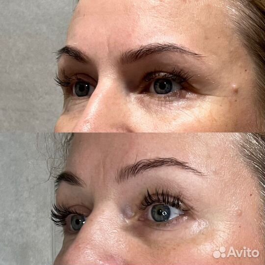 Глубокотканный массаж лица