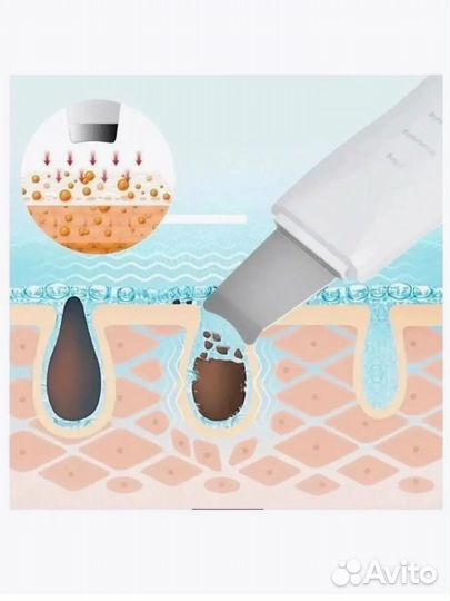 Аппарат для Ультразвуковой чистки лица + Лифтинг