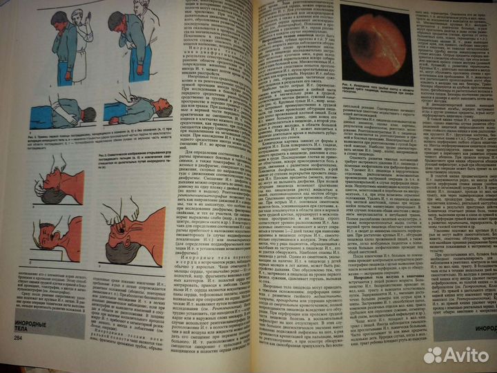 Малая медицинская энциклопедия