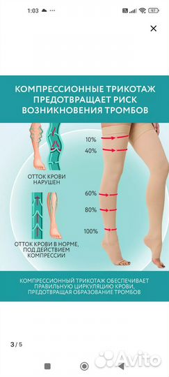 Компрессионный чулок