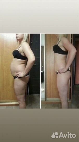 Антицеллюлитный массаж