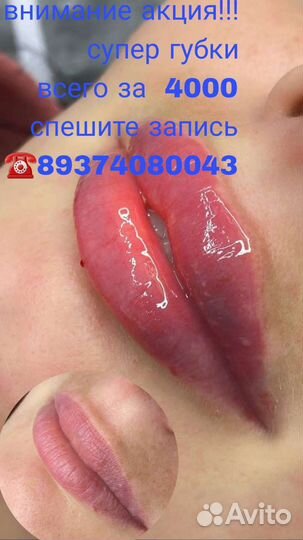 Биоревитализация