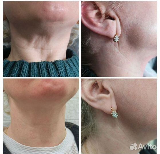 Холодная плазма