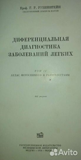 Рубинштейн Диференциальная диагностика заболеваний