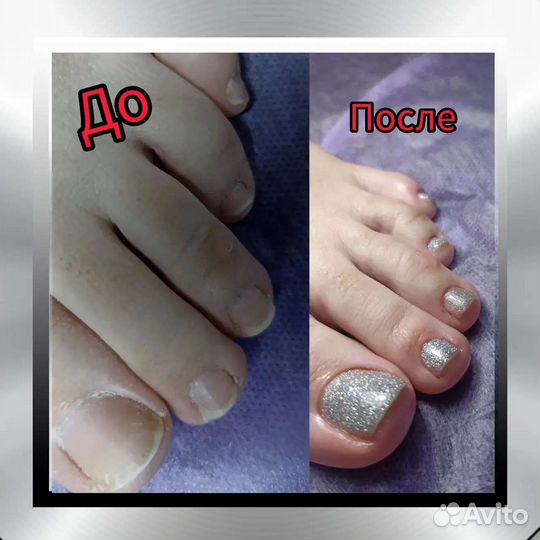 Аппаратный педикюр