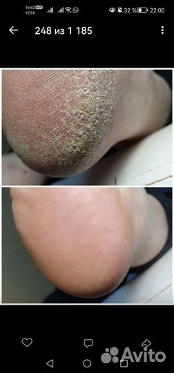 Маникюр с покрытием гель-лаком