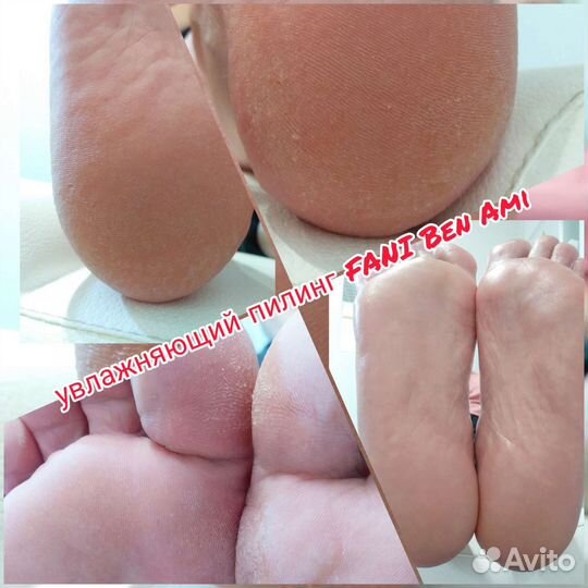 Педикюр подология