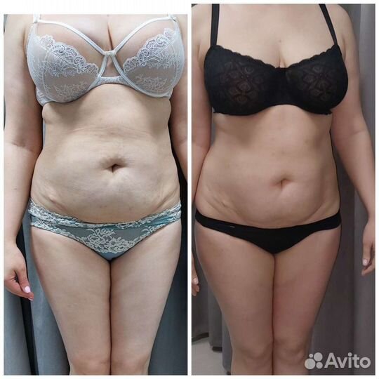 Аппаратный массаж