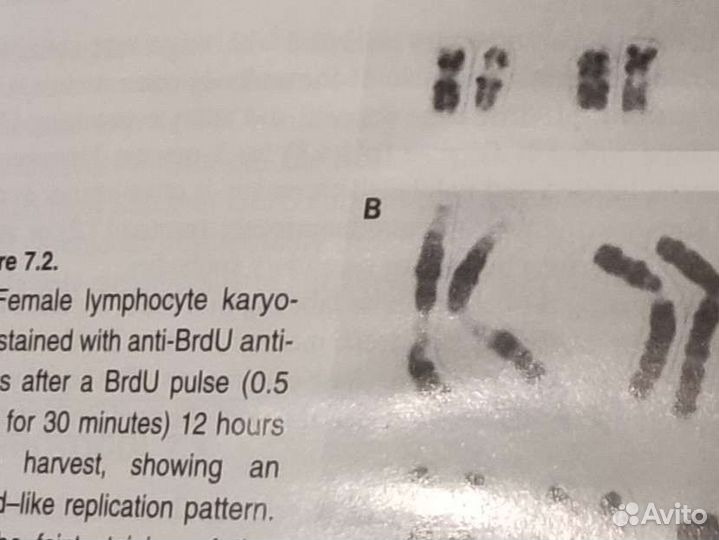 Книга Human chromosomes