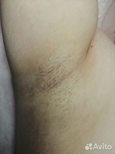 Электроэпиляция,Шугаринг, Чистка лица, массаж лица