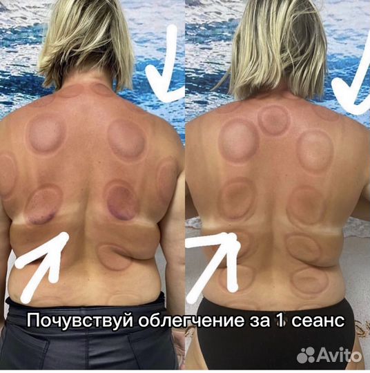 Массаж Сходненская Митино