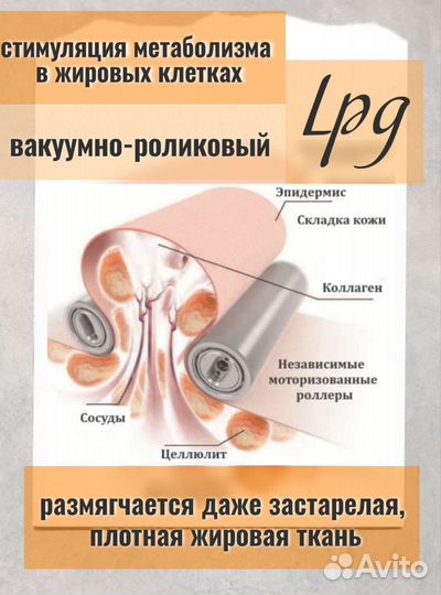 LPG массаж