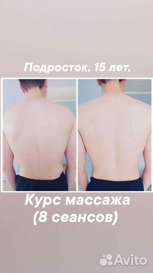 Оздоровительный массаж