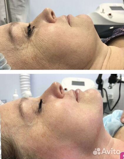 Оздоровительный массаж