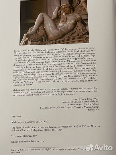 The breast, молочная железа