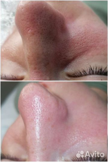 Косметологические услуги