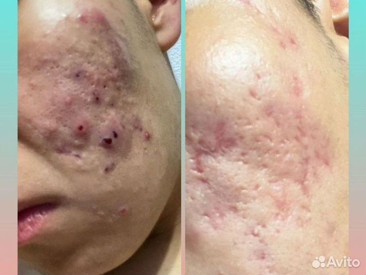 Клеточное питание