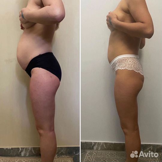 Аппаратный массаж