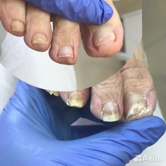 Услуги профессионального подолога