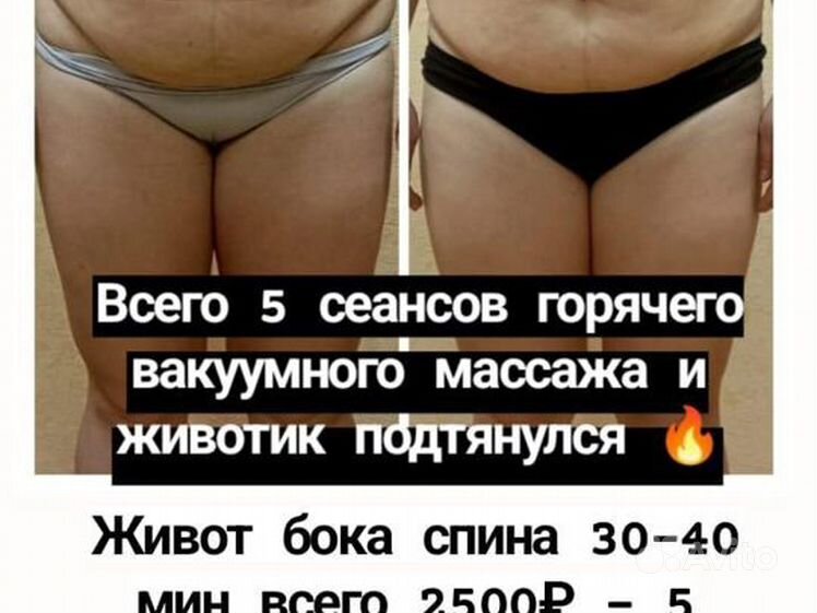 Лимфодренажный массаж в Чебоксарах