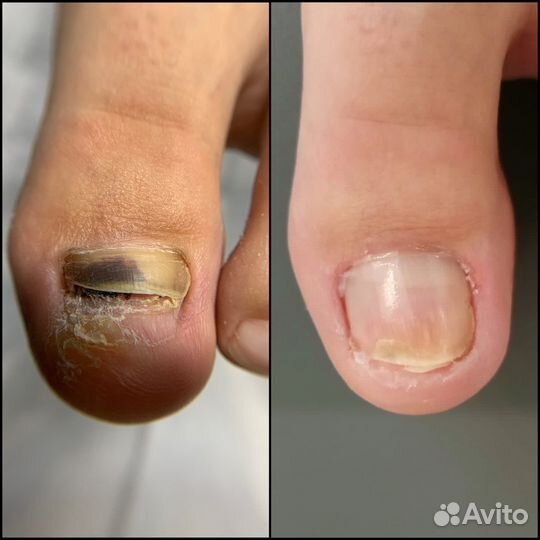 Подолог. педикюр. маникюр