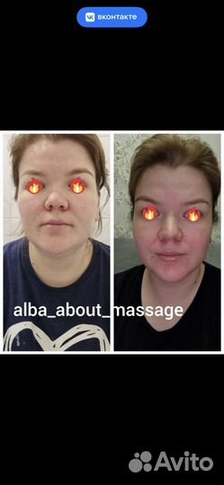 Массаж лица Сплит