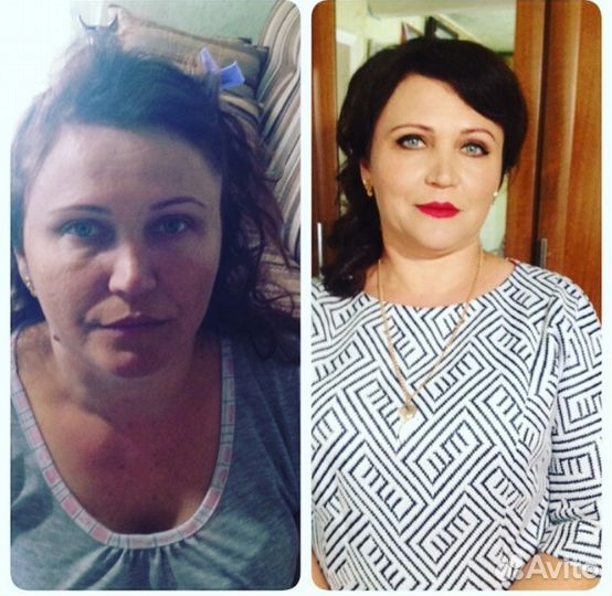 «Ботокс» для волос