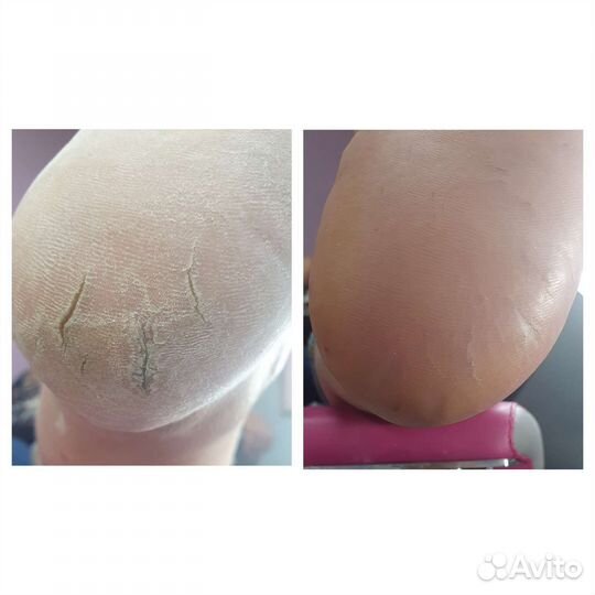 Подолог/ индивидуальные стельки