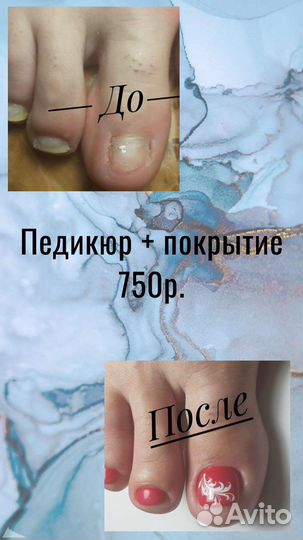 Педикюр, подология