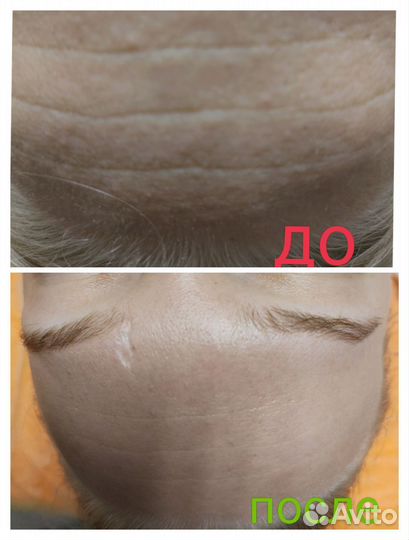 Массаж.Естественное омоложение без инъекций