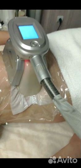 Криолиполиз