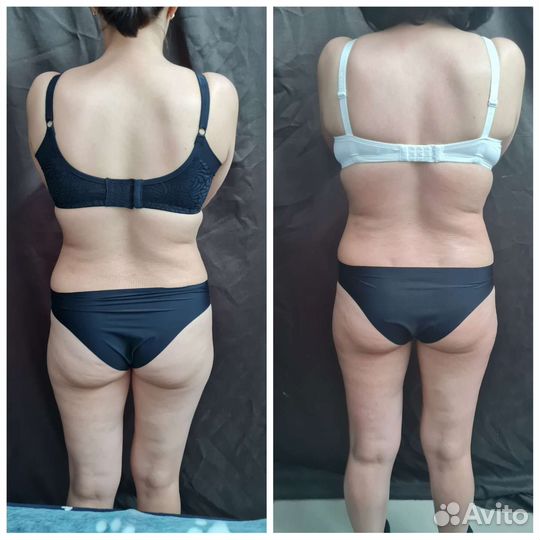 Ручной антицелюлитный массаж