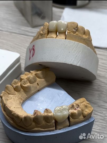 Зубной техник керамист