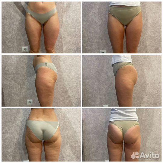 Классический Массаж