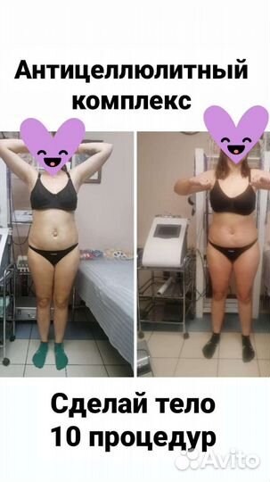 Вакуумный массаж. Коррекция фигуры. Похудение