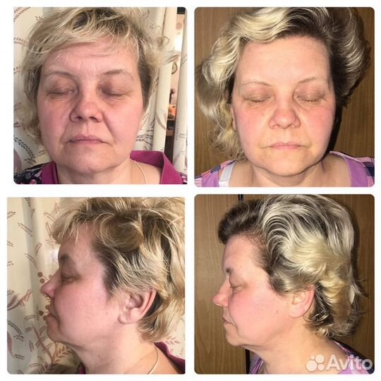 Миофасциальный массаж лица