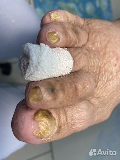 Педикюр подология