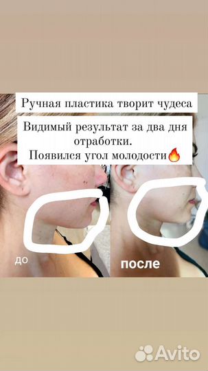 Массаж лица