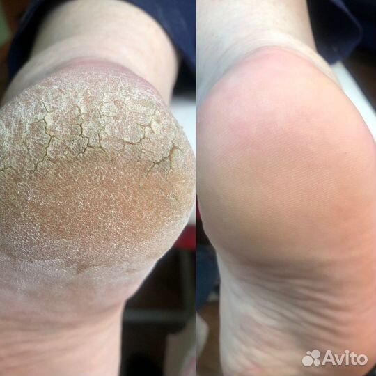 Маникюр Смарт педикюр Наращивание ногтей