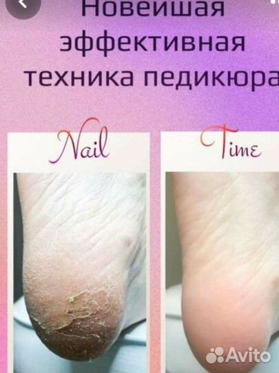 Педикюр и маникюр на дому