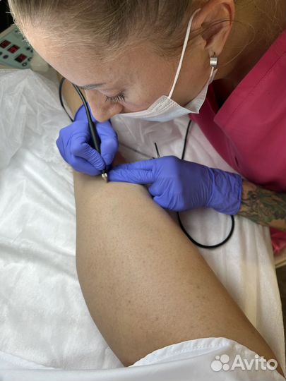 Депиляция Воском Электроэпиляция уз чистка бикини