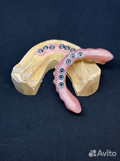 All on 4 протез, изготовление