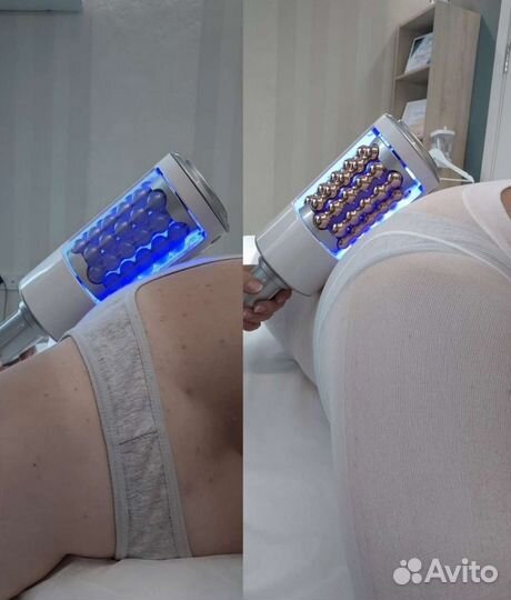 Модель на коррекцию фигуры